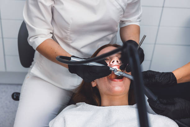 Best Knocked-Out Tooth (Avulsed Tooth) Treatment in Upland, CA